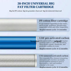 Intelligent Ultrafiltration Water purification system Portable 5-Grade Stainless Steel UF Manual Household Sink Filter Outdoor Use water Purifier